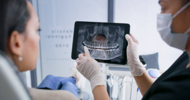 Licensed Wisdom Tooth Removal service in Cabarrus County County, NC - Smile Center Dentistry